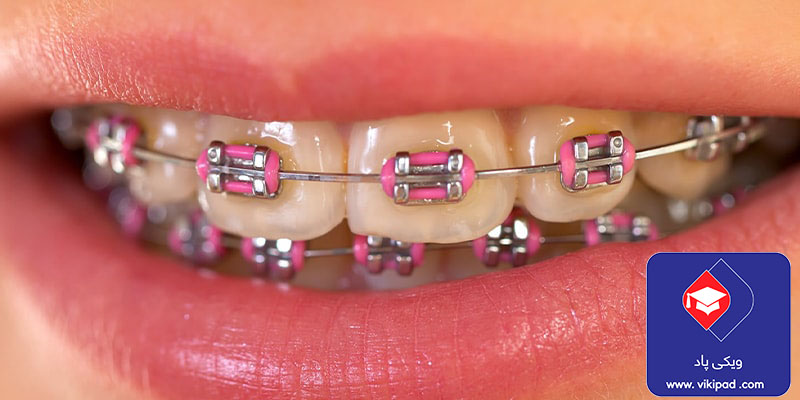 ارتودنسی و دندان توسط یک متخصص مجرب